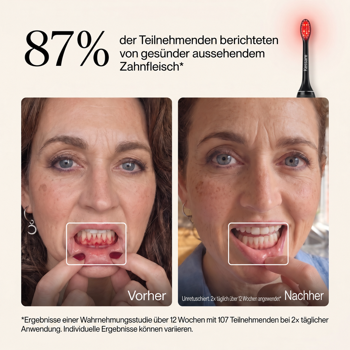 Kessare Zahnbürste für gesundes Zahnfleisch