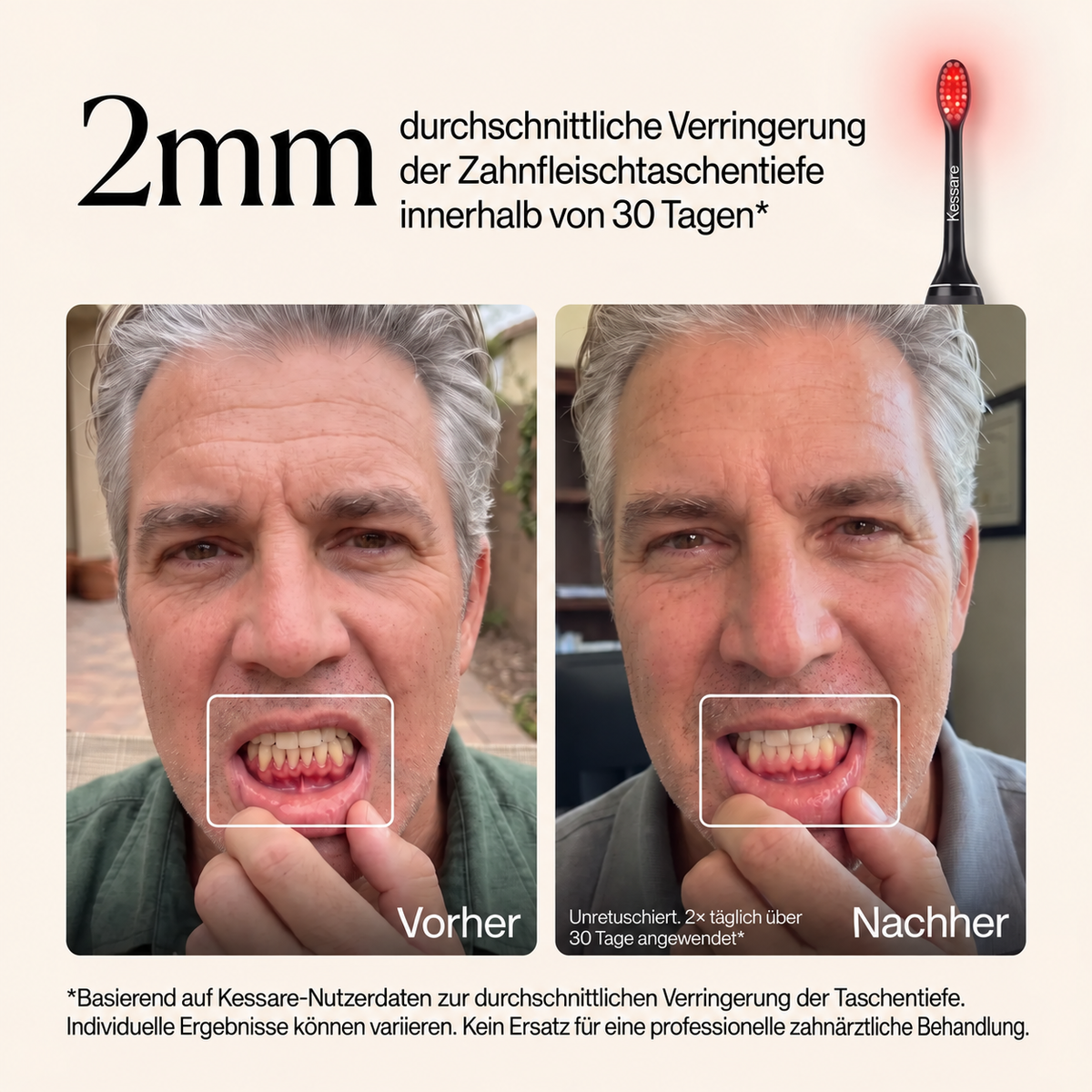 Kessare Zahnbürste für gesundes Zahnfleisch